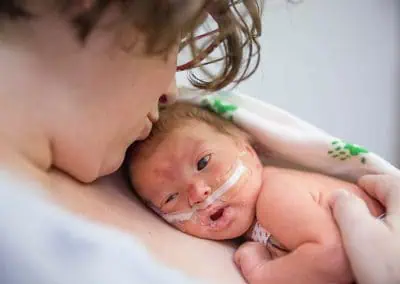 A parent holding a newborn baby with medical tubes attached, providing skin-to-skin contact for comfort and care, even during out-of-hours at Watkin Medical.