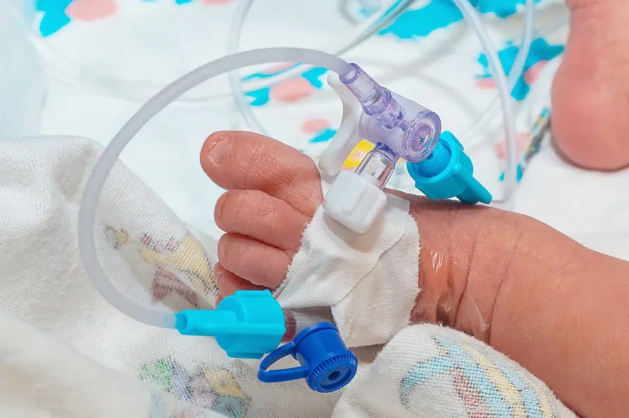 Cannulated baby undergoing neonatal intensive care